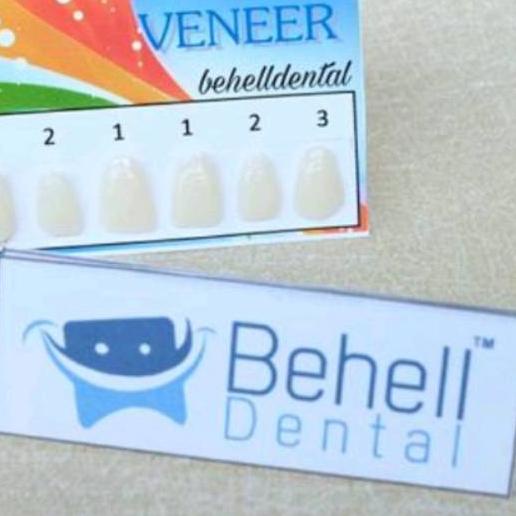 Teeth Veneer, Gigi Aplikasi, Gigi Kelinci. Vener