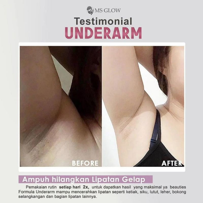 MSGLOW Underarm Pemutih Ketiak &amp; Selangkangan Bokong Mencerahkan Lipatan Hitam Mulus Halus MS GLOW
