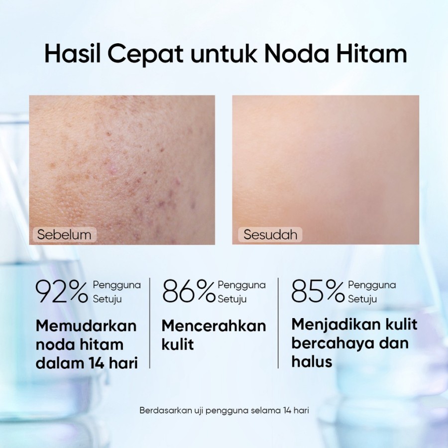 ✨ AKU MURAH ✨ SKINTIFIC SymWhite 377 Dark Spot Eraser Serum Brightening Serum 20ml