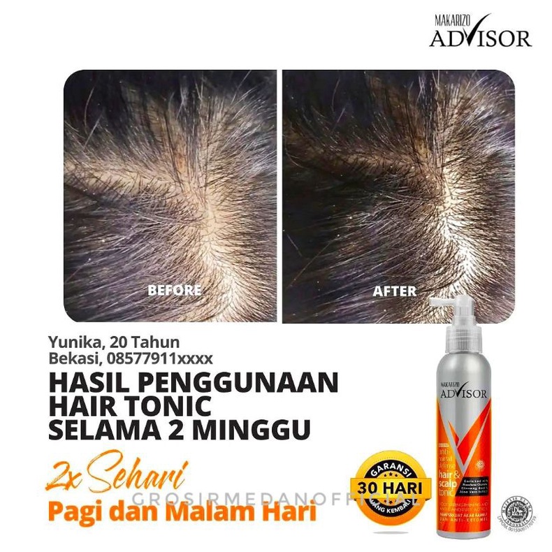 MAKARIZO ANTI HAIR FALL DEFENSE - TONIK ANTI RAMBUT RONTOK DAN KETOMBE - MAKARIZO ADVISOR HAIR AND SCALP TONIC