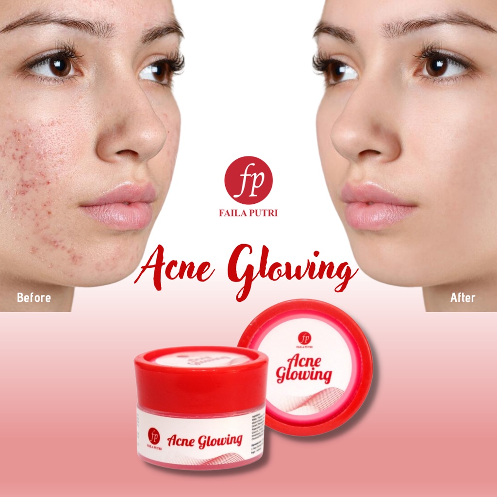 ACNE GLOWING FAILA PUTRI/Night Cream for lightening Acne FP BPOM / krim malam jerawat