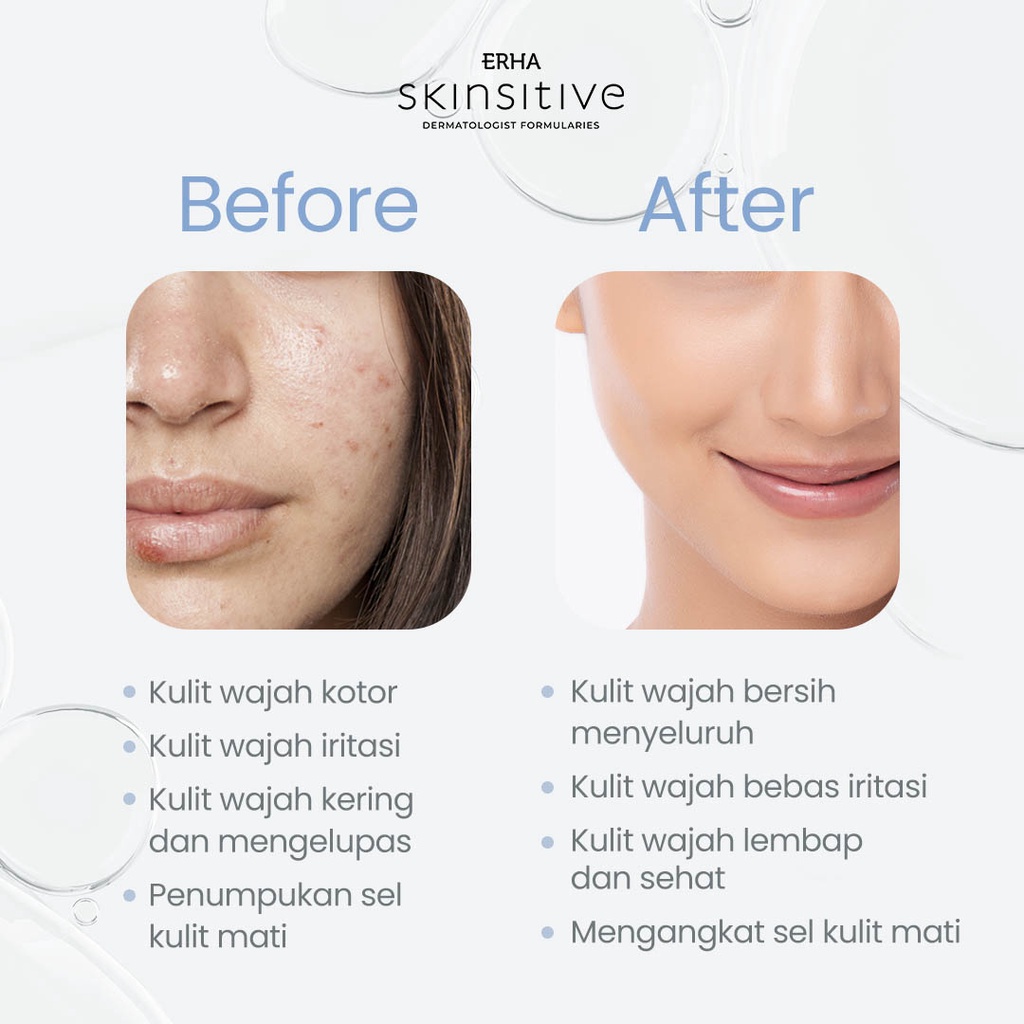 ❤ MEMEY ❤ ERHA Skinsitive Ultracalm Face Wash For Sensitive Skin 80g