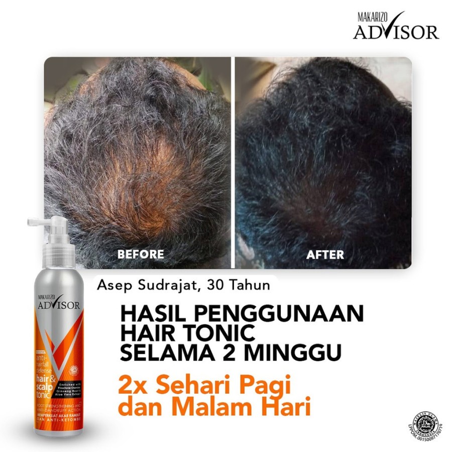 Makarizo Advisor Hair Tonic 2 in 1 Untuk Rambut Rontok Dan Ketombe