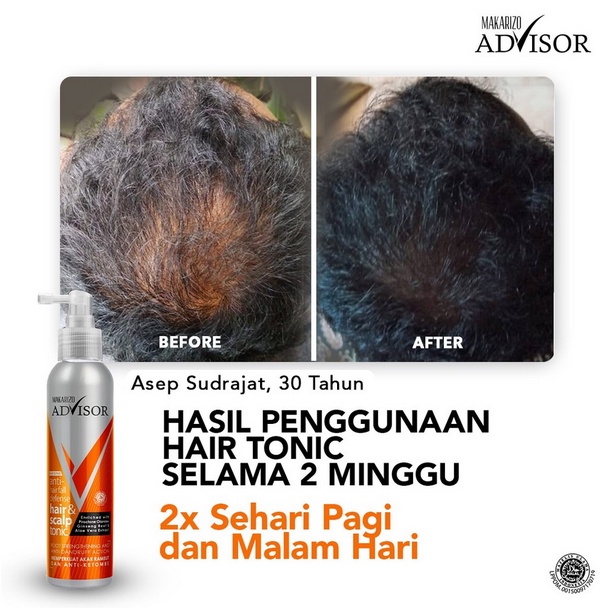 ❤ jselectiv ❤ MAKARIZO ADVISOR Hair &amp; Scalp Tonic - 145ml | Tonik Perawatan Rambut Rontok dan Ketombe MAKARIZO