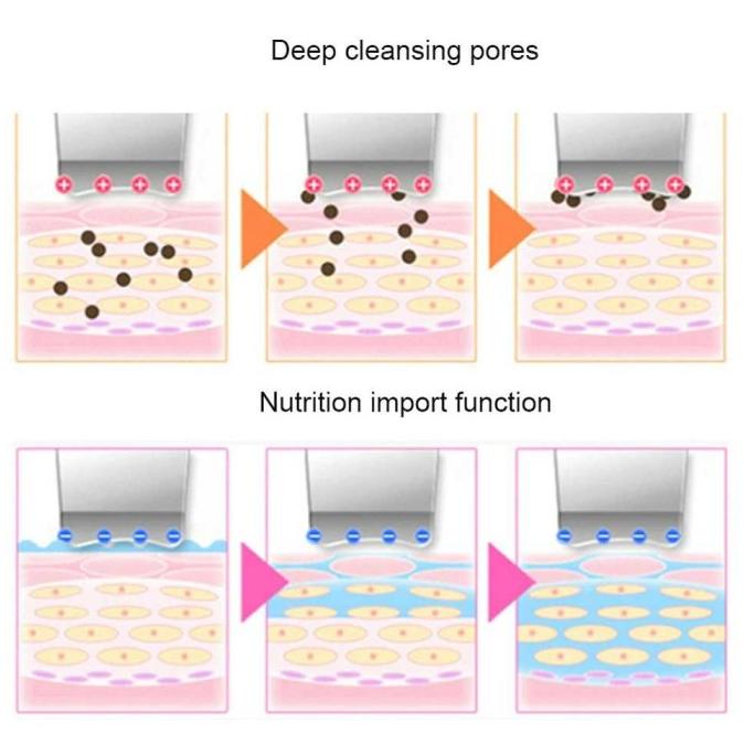 Alat Kecantikan Pembersih Wajah Elektrik Ultrasonic Facial Scrubber