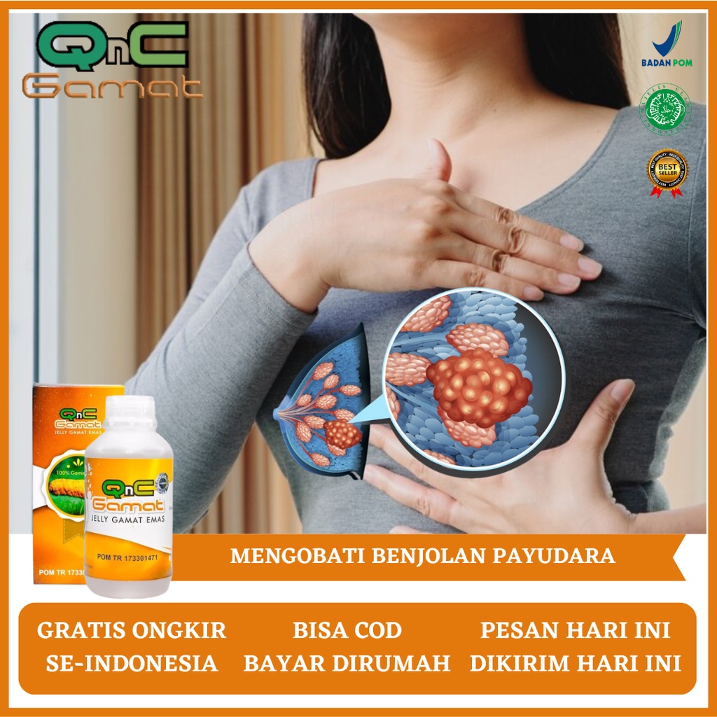 Obat Benjolan, Obat Benjolan Payudara, Obat Benjolan Abses Payudara, Obat Benjolan Payudara Kanker, 