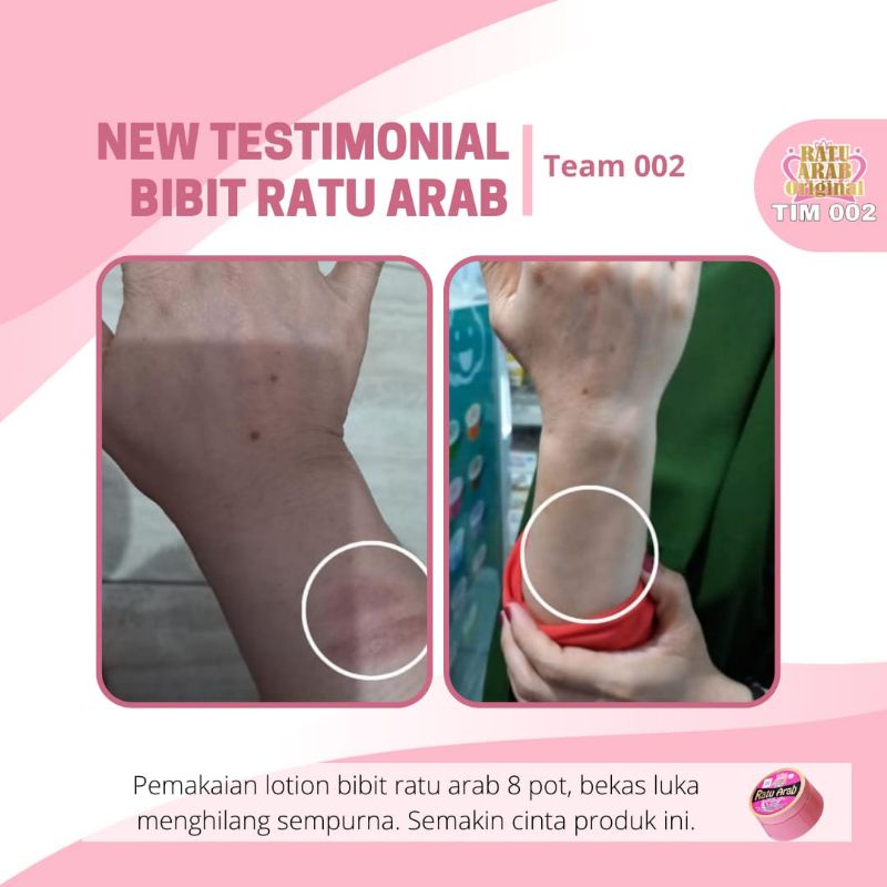 Lotion whitening Ratu Arab