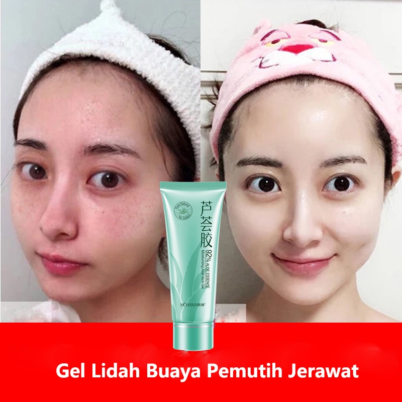 Gel Lidah Buaya krim pelembab wajah salep jerawat dan bekas jerawat 40g Ekstrak Lidah Buaya Mengekstrak Jerawat Penghapusan Bintik Hidrasi Pelembab Anti-Penuaan