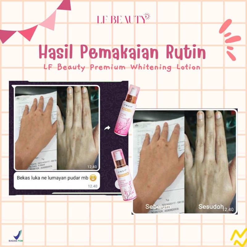 (BEST SELLER) HB LOTION SUPER WHITENG LF BEAUTY (APOTEK ANGGUN) NO MERKURI &BERPOM