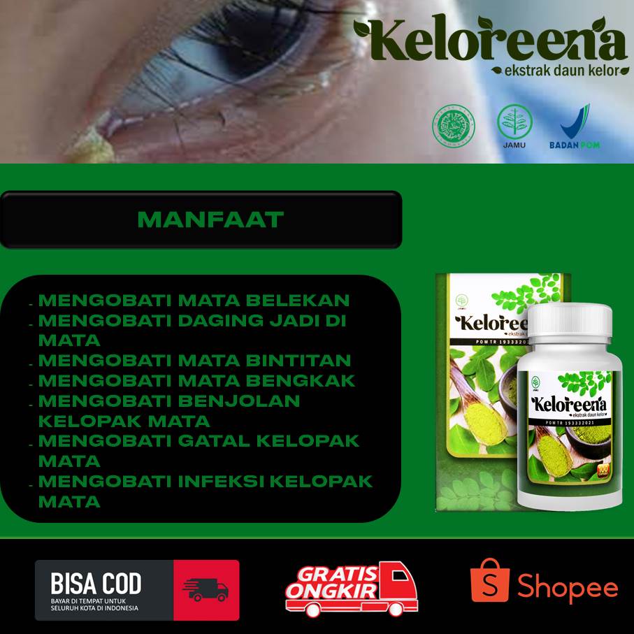 Obat Mata Belekan Bintitan Bengkak Benjolan Di Kelopak Mata Eksim Gatal Infeksi Kutil Blefaritis Mil
