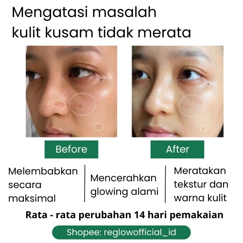 Toner Reglow dr.Sindy Skincare Wajah Glowing Pencerah Kulit Kusam Penghilang Komedo Mengecilkan Pori Pori Rglow Original Official Store