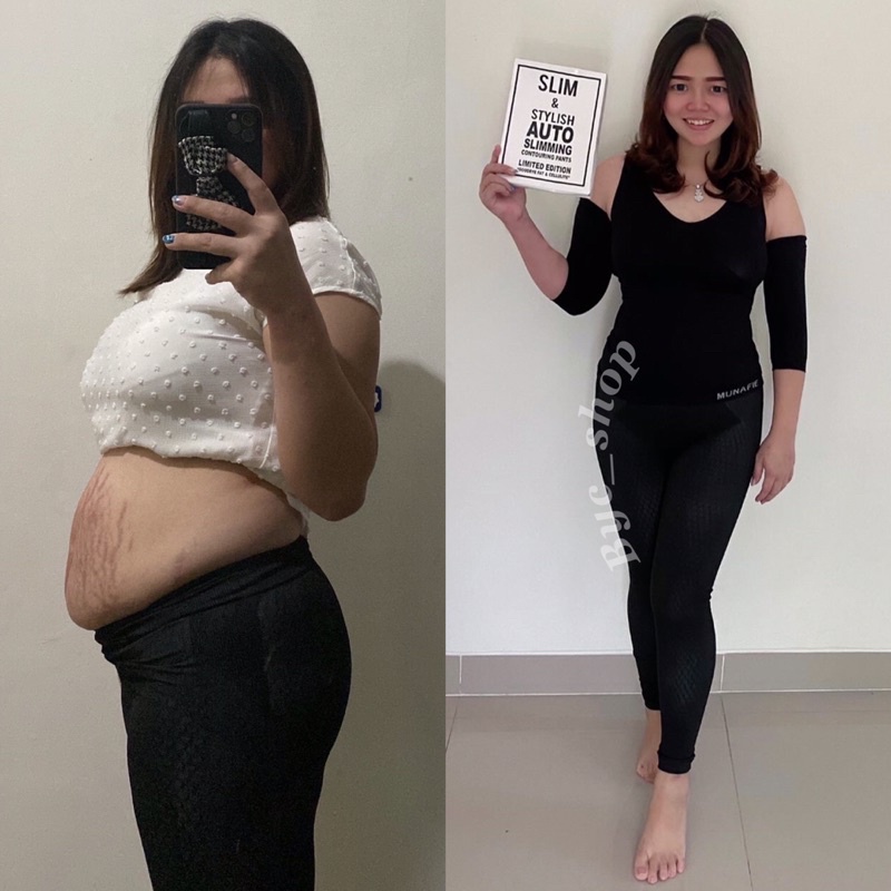 STARTER AUTOSLIM ANTOINETTE (BOOSTER KORSET SEDOT LEMAK)