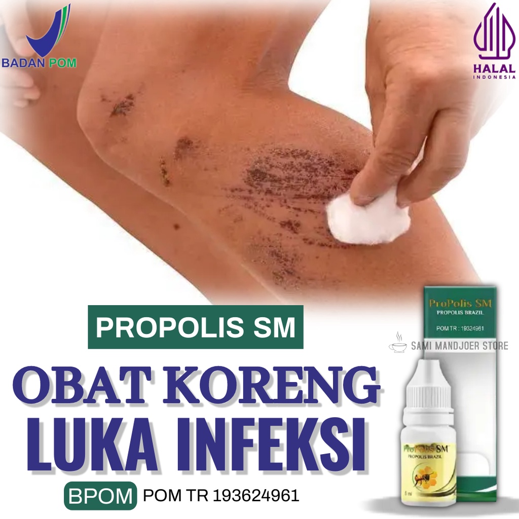Obat Koreng Salep Korengan Koreng di kaki dan tangan koreng di seluruh badan Koreng Akibat Luka Keri