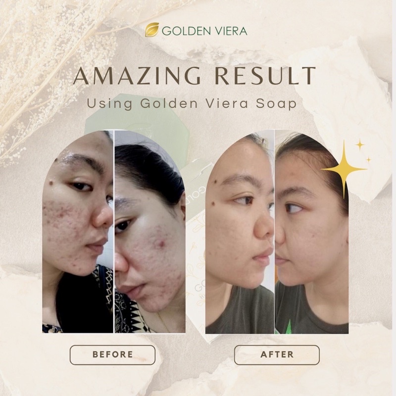 Golden Viera Herbal Soap Original Kemasan Baru Bebas Pilih Hadiah