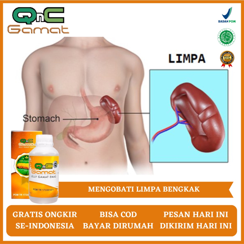 Obat Limpa, Obat Limpa Bengkak, Obat Sakit Limpa, Obat Pembengkakan Limpa, Obat Penyakit Limpa, Obat