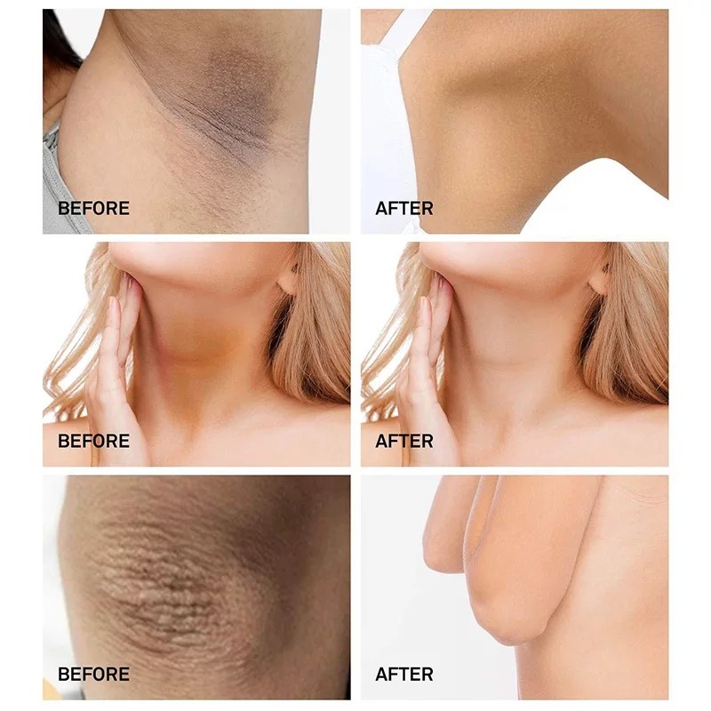 Whitening Cream Brighty glowing underarm Krim Pemutih Krim Pemutih Ketiak 60ml  Ringan Tidak Mengiritasi Mengurangi Melanin Memutihkan Kulit Seluruh Tubuh