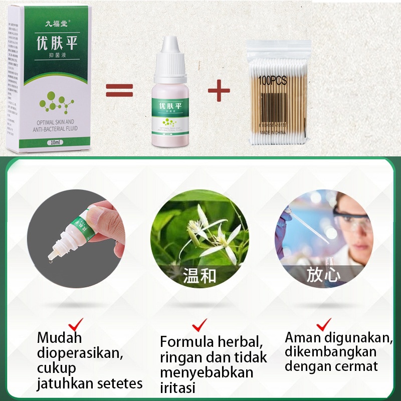 Cairan Obat Untuk Kutil Plester Kutil Mata Ikan Kaki Kapalan Ji Yan Gao Obat Kutil Kapalan Mata Ikan Kaki Callusol / Calusol / Kalusol (Mata Ikan Kalusol, Obat Kutil)