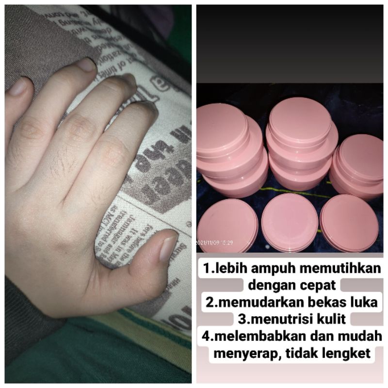 Hb whitening farmasi