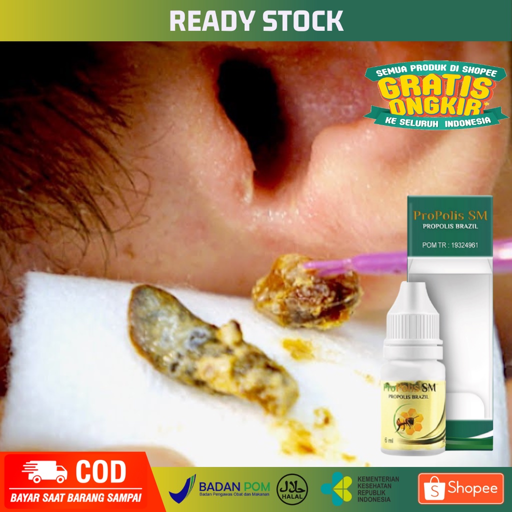 Obat Tetes Kotoran Telinga - Penghancur Kotoran Telinga Keras