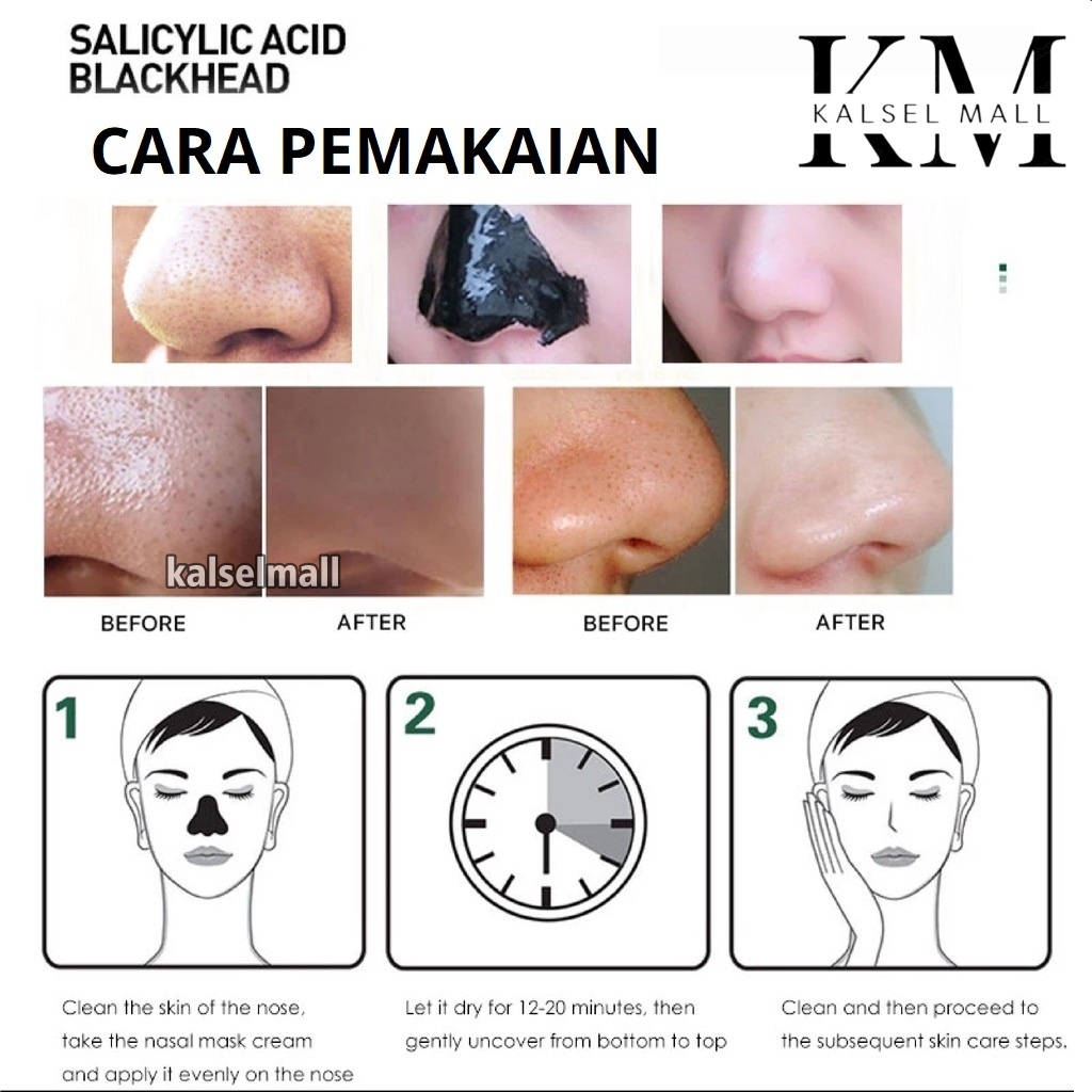 Masker Pengangkat Pembersih Pencabut Penghilang Komedo Hidung Wajah Salicylic Acid Blackhead 100% Original Pore Strip Zooson Charcoal Black Head Nose Pack Peel Off Kream Cream Krim Khomedo Jerawat Kulit Berminyak Noda Flek Hitam OC12