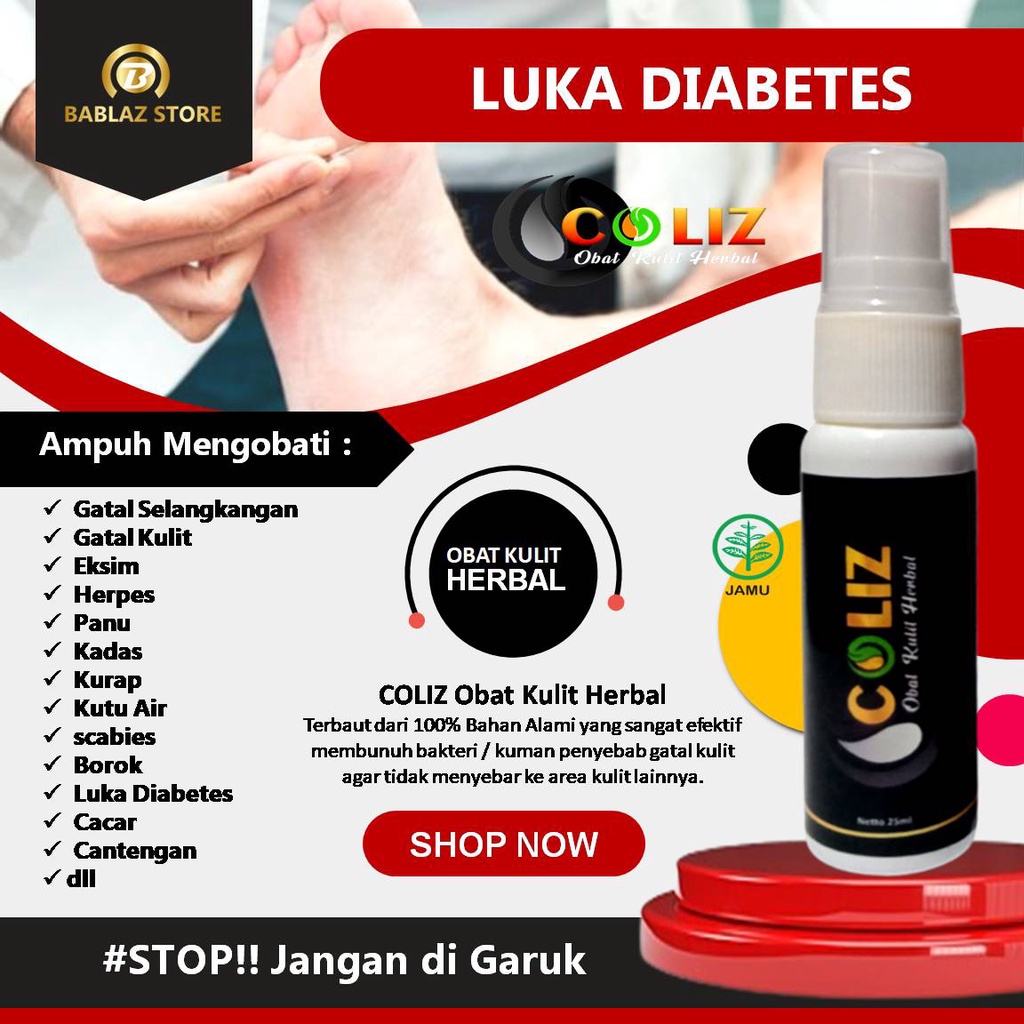 OBAT LUKA DIABETES JAMUR EXIM EKSIM GATAL KEPALA BOROK CANTENGAN GATAL SELANGKANGAN AMPUH COLIZ