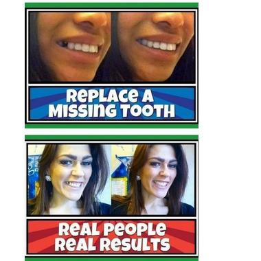 PROMO PENAMBAL GIGI OMPONG TEMPTOOTH ORIGINAL MURAH 300 BUTiR Lebih