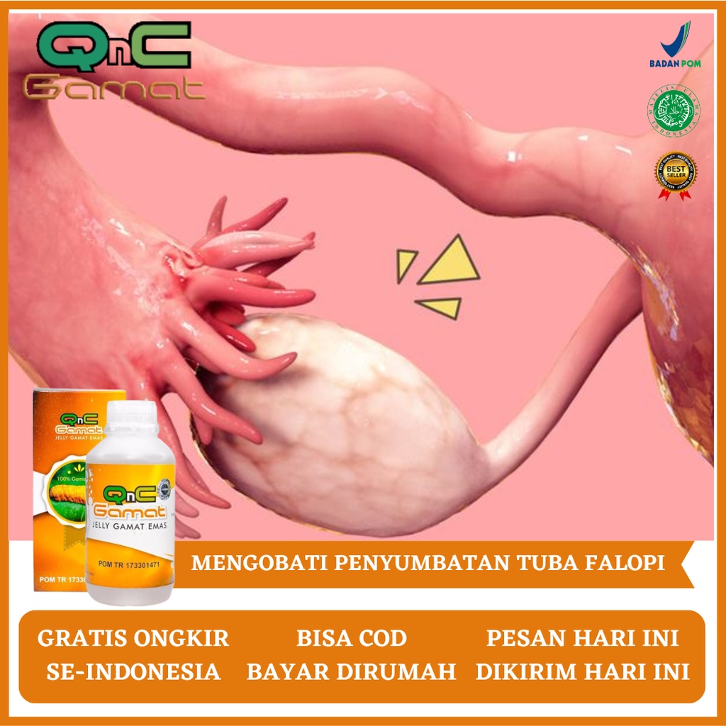 Obat Tuba Falopi, Obat Penyumbatan Tuba Falopi, Obat Tuba Falopi Tersumbat, Obat Herbal Tuba Falopi 