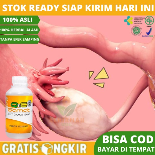 Obat Tuba Falopi Tersumbat, Susah Hamil, Obat Saluran Tuba Falopi Tersumbat, Obat Herbal Tuba Falopi
