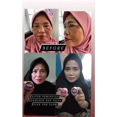 SUNCREEN FNB ORIGINAL &amp; SALEP FLEK &amp; JERAWAT BY FNB GLOW