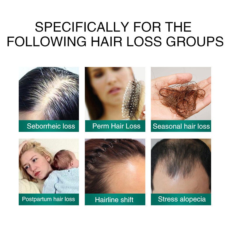 Penumbuh Rambut Dan Mengatasai Rambut Rontok Hingga Rambut Botak Penumbuh rambut botak Serum 30ml Hair growth serum Penumbuh rambut cepat-3