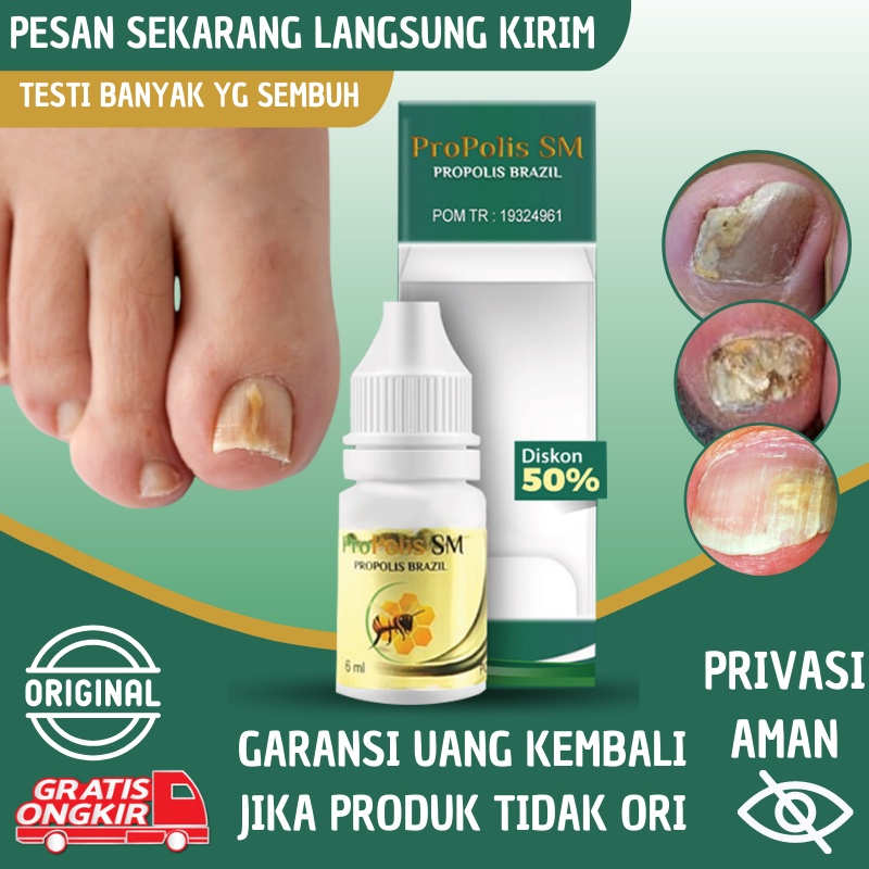 Jual Obat Kuku Jamur Dan Rusak Obat Jamur Kaki Obat Kuku Busuk Obat