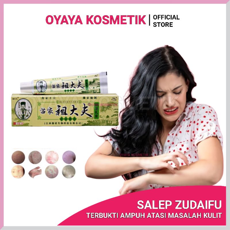Salep Zudaifu Ampuh Atasi Penyakit Kulit Akut Kronis Eksim Jamur Psoriasis Mengelupas Melepuh Kaki/Tangan Gatal Pruritus Vulvae Wasir Gigitan Nyamuk Jerawat Biang Keringat Kulit Kurap Akibat Gigitan Serangga BERKUALIAS OYAYA KOSMETIK PEKANBARU