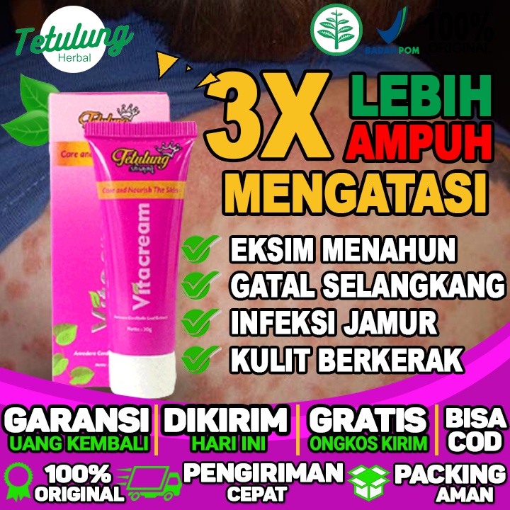 Salep Bisul Kecil  Salep Bisul Kaki  Salep Bisul Kepala Bayi  Salep Eksim Menahun Yang Ampuh  Obat E