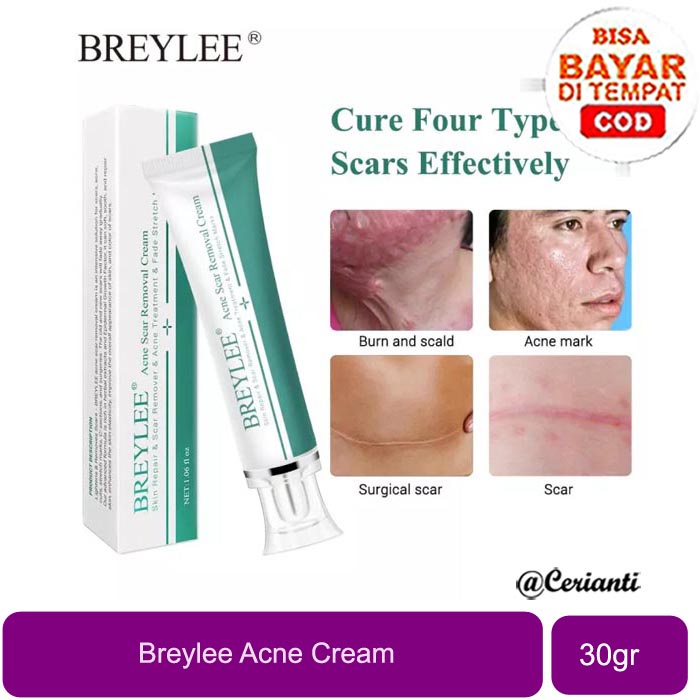 Breylee Acne Cream (Tube) - 30gr_Cerianti