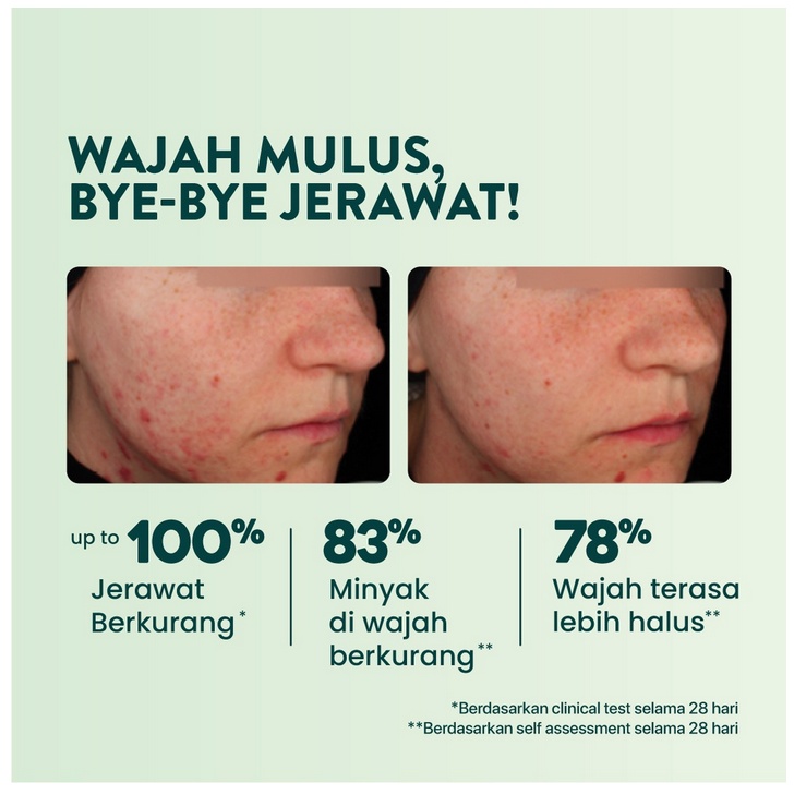 B08 N'PURE centella asiatica face essence cica serum wajah mengatasi bekas jerawat beruntusan bruntusan anti acne oily face berminyak kering dry wajah skincare npure murah termurah asli original aging kerutan garis halus putih kulit