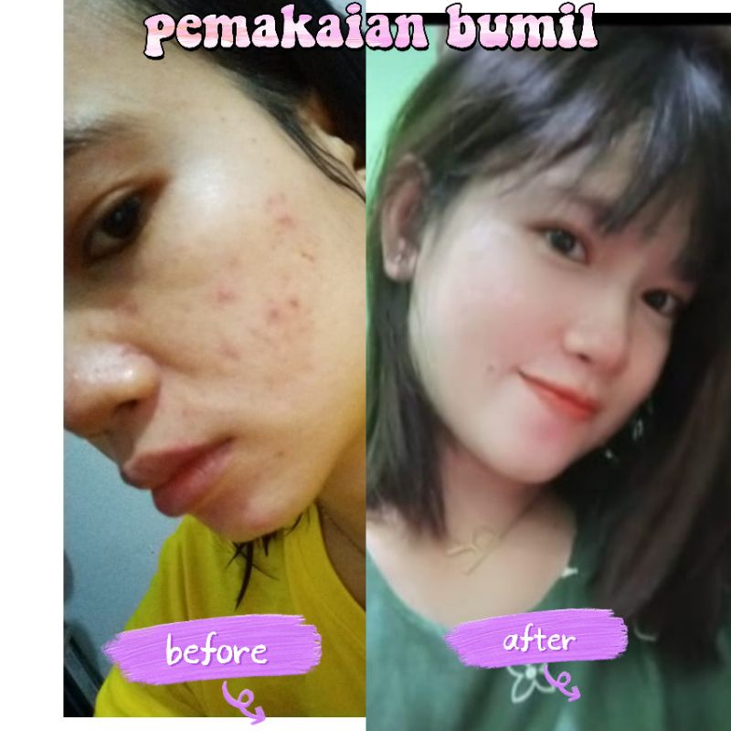 glow up Skincare routine