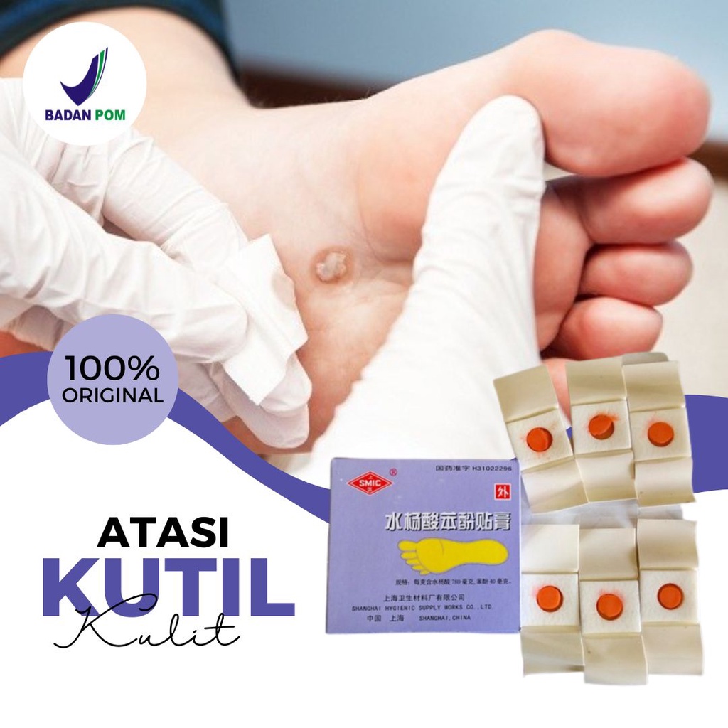 Obat Kutil Di Leher Tangan Wajah Ampuh Plester Mata Ikan Dan Kapalan Plaster Hansaplast Ji Yan Gao H