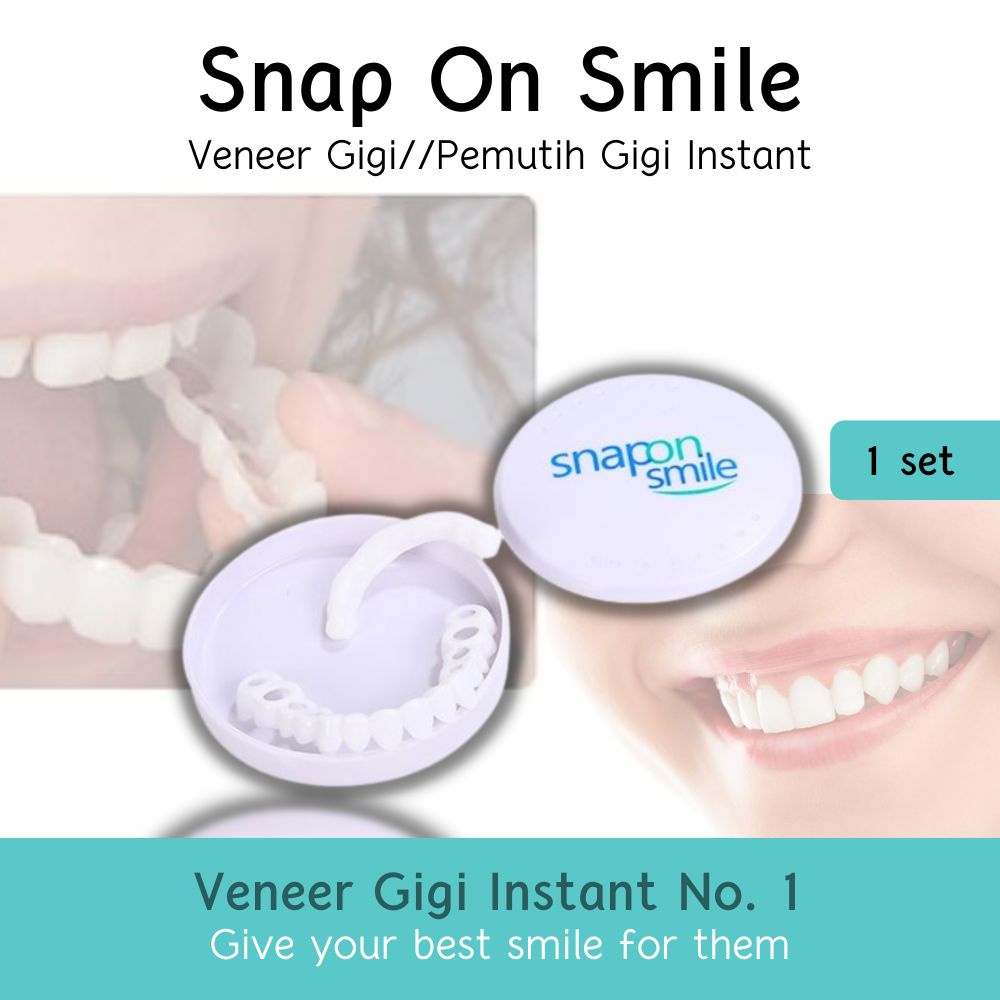 Snap On Smile Original Veneer Snap On Smile 100 veneer original veneers original veener venner venee