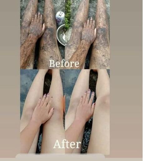 FREE ONGKIRPAKET CEPAT PUTIH BEKAS LUKA HILANG || TERMURAH || PILIH VARIASI|SQ1