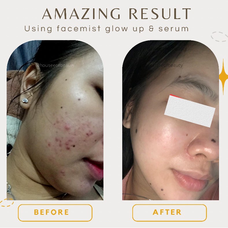 serum wajah glowing brightening | serum glowing pemutih wajah dan flek | new skin youth revolution plus