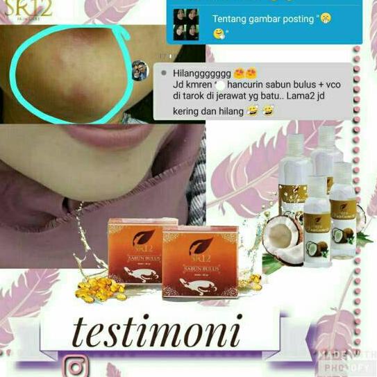 

COD✔️Vco / virgin coconut oil / minyak kelapa murni|RA3