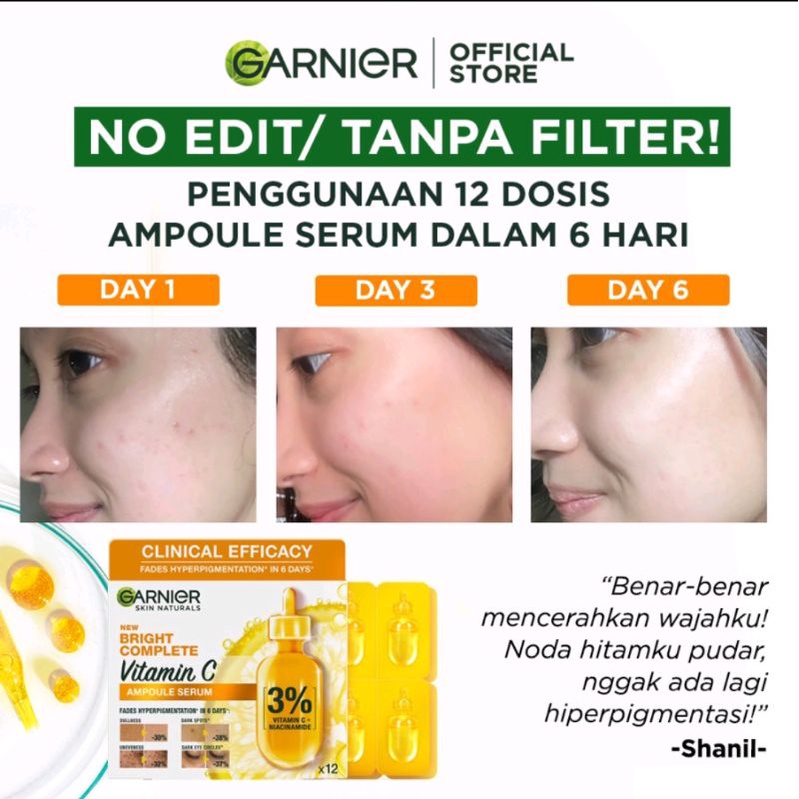 Garnier Bright Complete Ampoule Vitamin C Hiperpigmentasi Serum