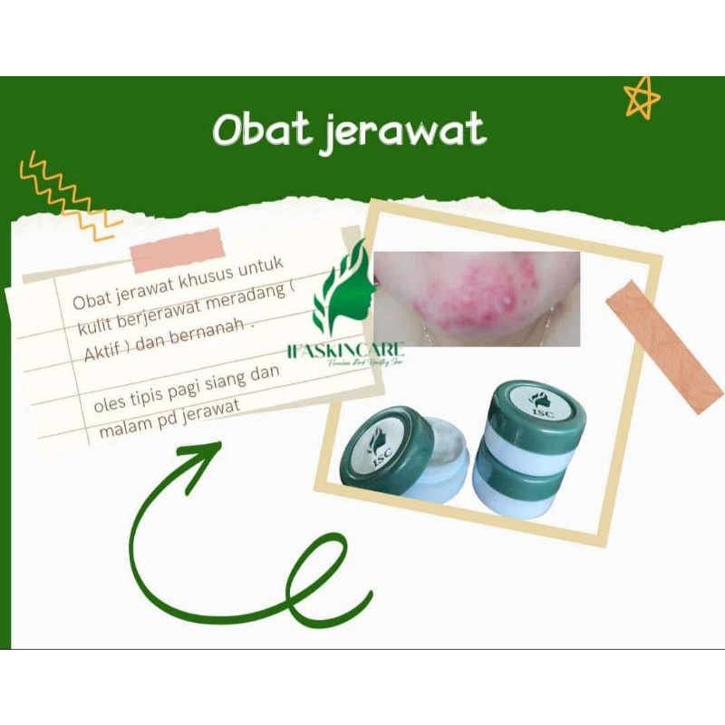 Obat Acne Salep Jerawat Ifskincare/ ifaskincare