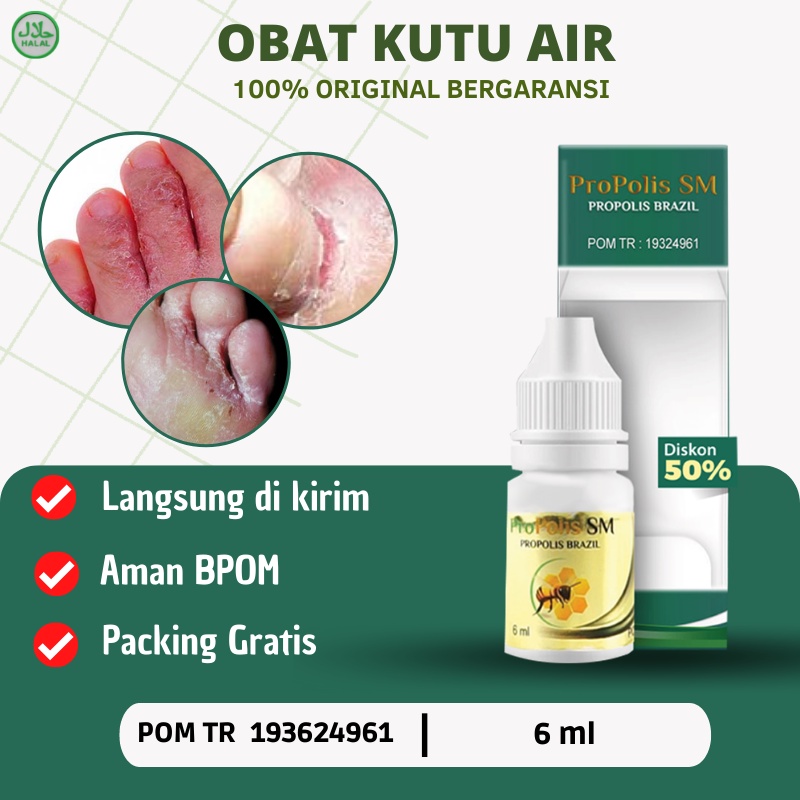 Obat Kutu Air