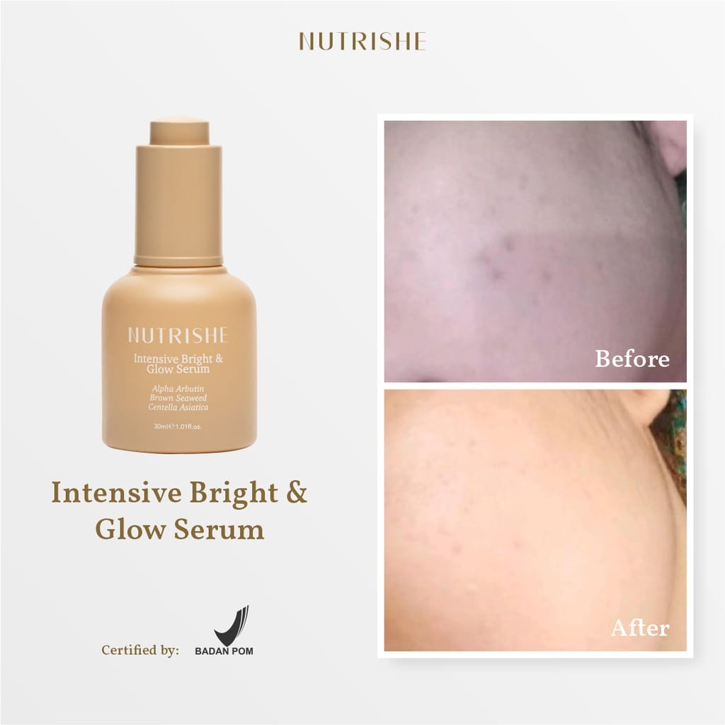 SisterBeauty - Nutrishe Intensive Bright &amp; Glow Serum - 20mL | 30mL