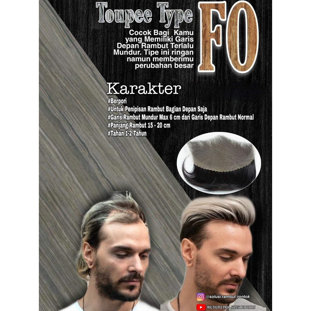 Hair toupee wig pria wanita rambut palsu original asli 100% remy human hair replacement ( FON )