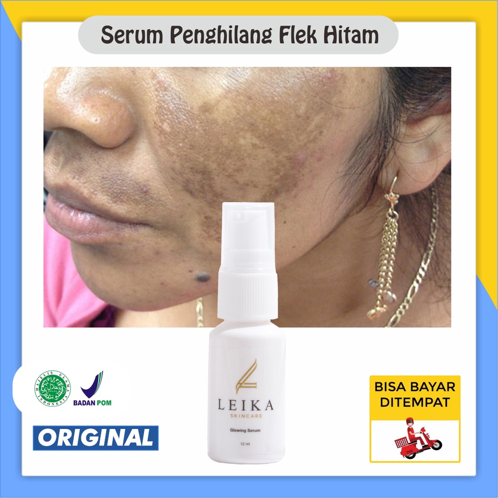 AMPUH Serum Penghilang Flek Hitam Membandel Menahun obat flek hitam Perawatan Wajah Flek Serum Serum