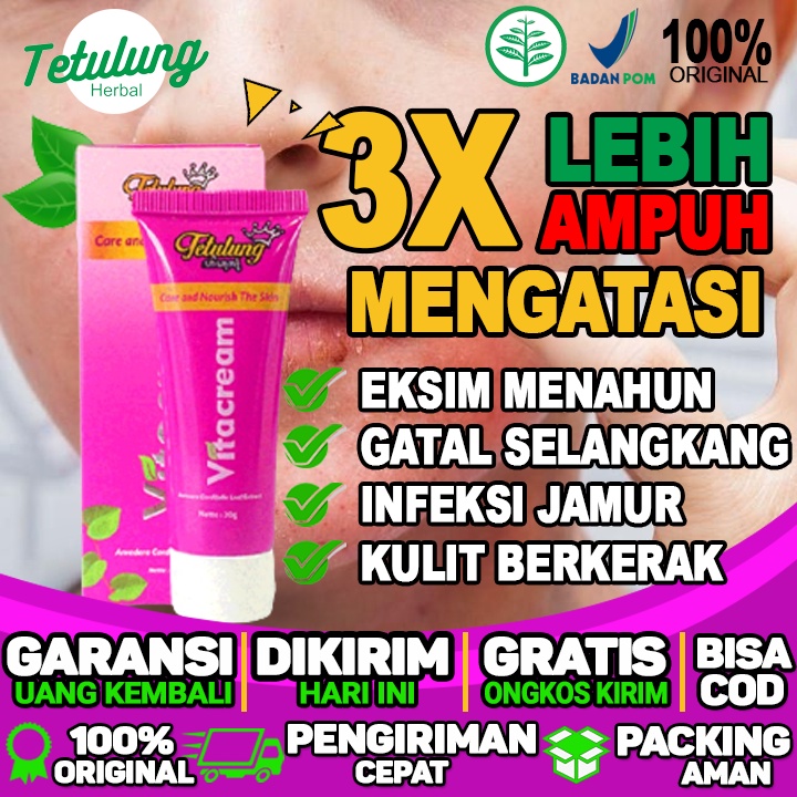 obat eksim kering menahun di kaki obat eksim kulit kaki obat eksim kering alami