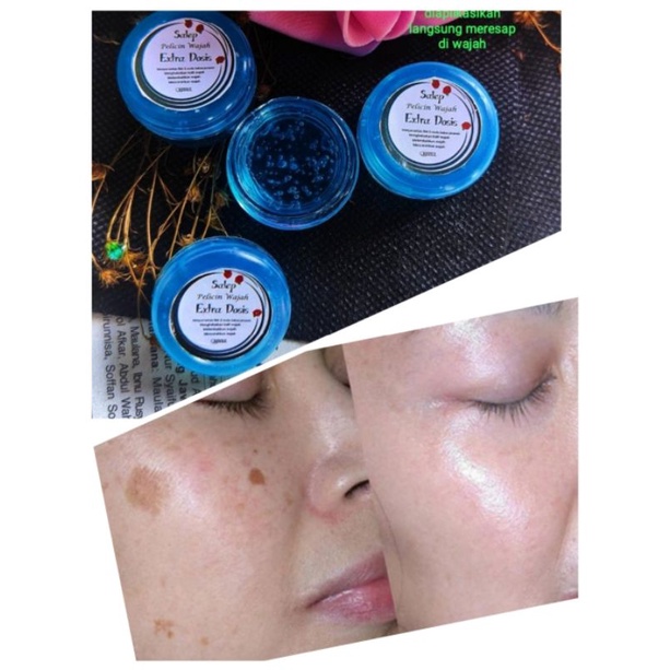 CREAM LINSKY HIJAU BRUNTUSAN DAN ANTI PENUAAN ORIGINAL SEGEL+HOLOGRAM