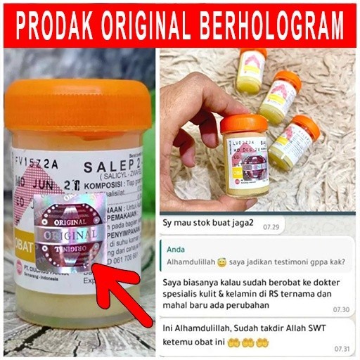 Salep Gatal Zwafel 24 Asli Original 100% | Obat Saleb Gatel Panu Kadas Kurap Kutu Air Eksim Scabies Selangkangan